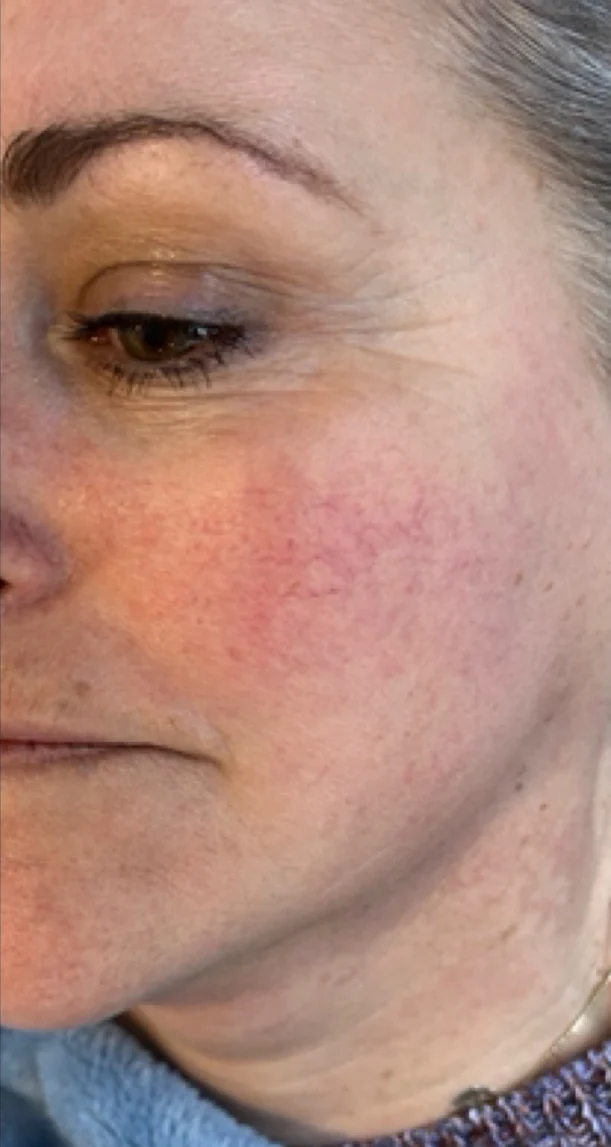 Before treatment 8