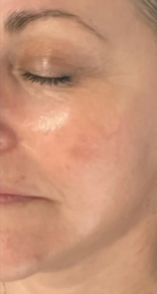 After treatment 8