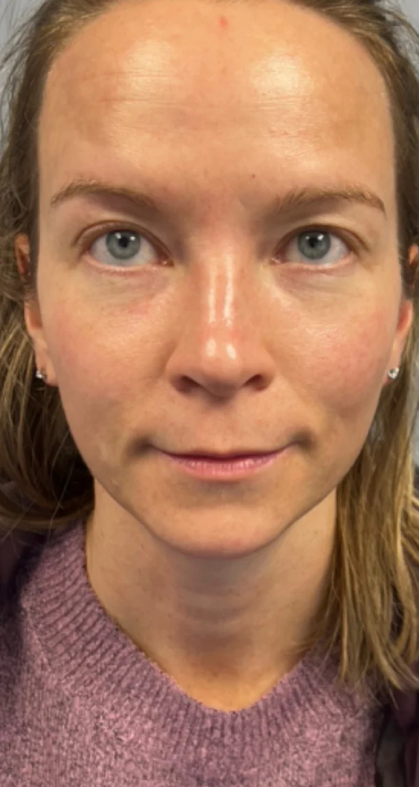 After treatment 6