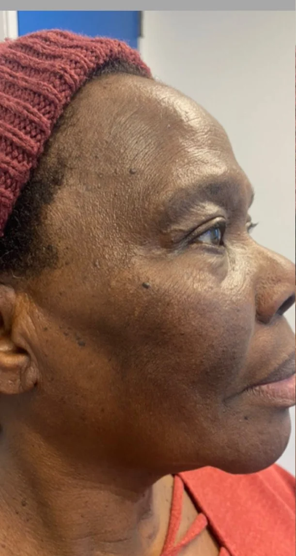Before treatment 10