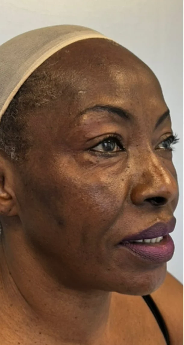 Before treatment 1