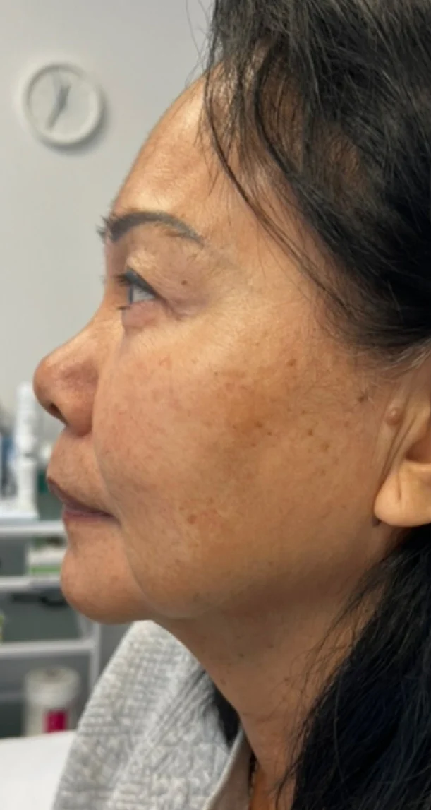 Before treatment 2