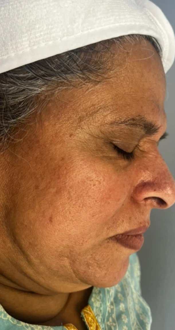Before treatment 4