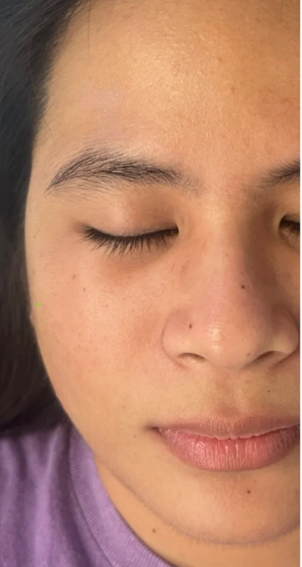 Before treatment 7