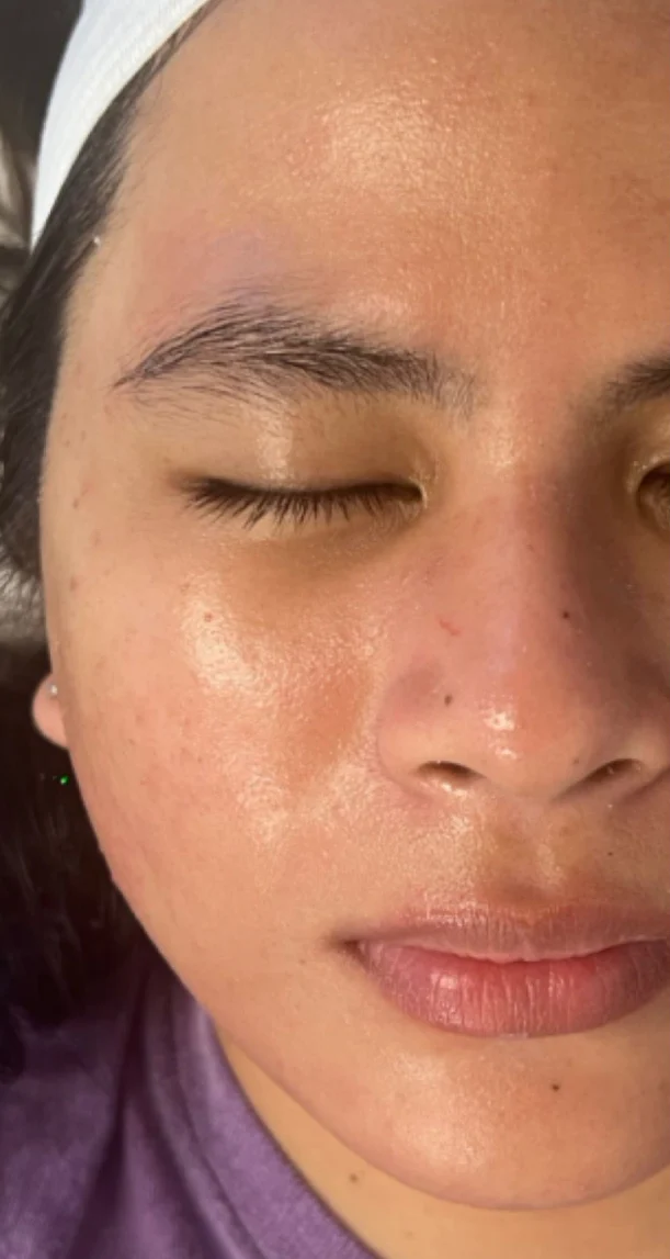 After treatment 7