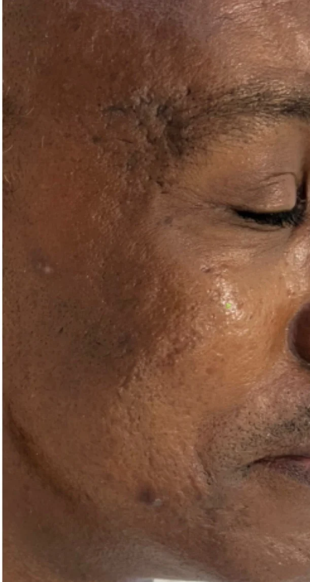 After treatment 5