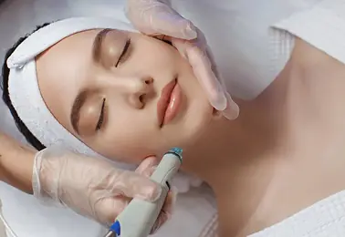 Skin treatment service Edmonton — New Skin Laser Studio